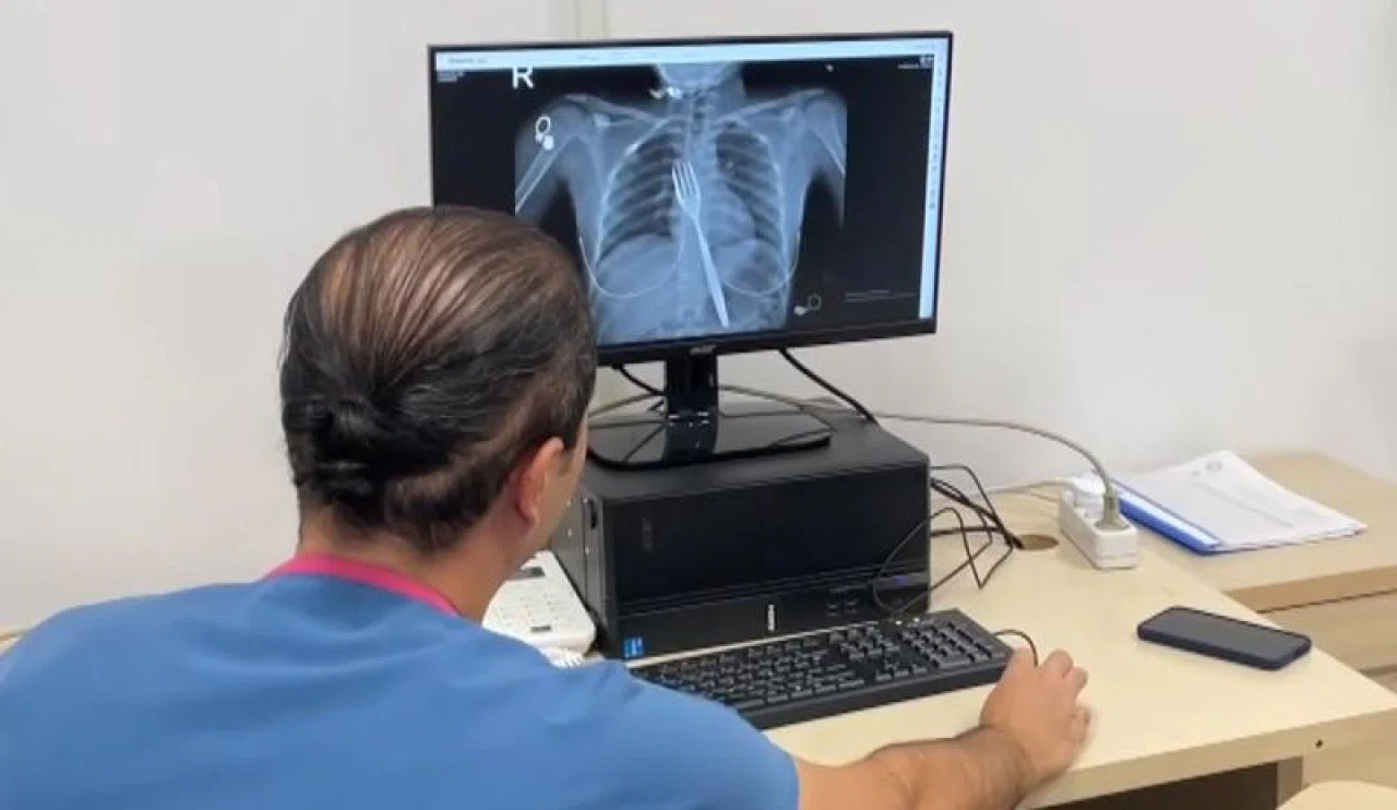 18 santimlik çatal yuttu!