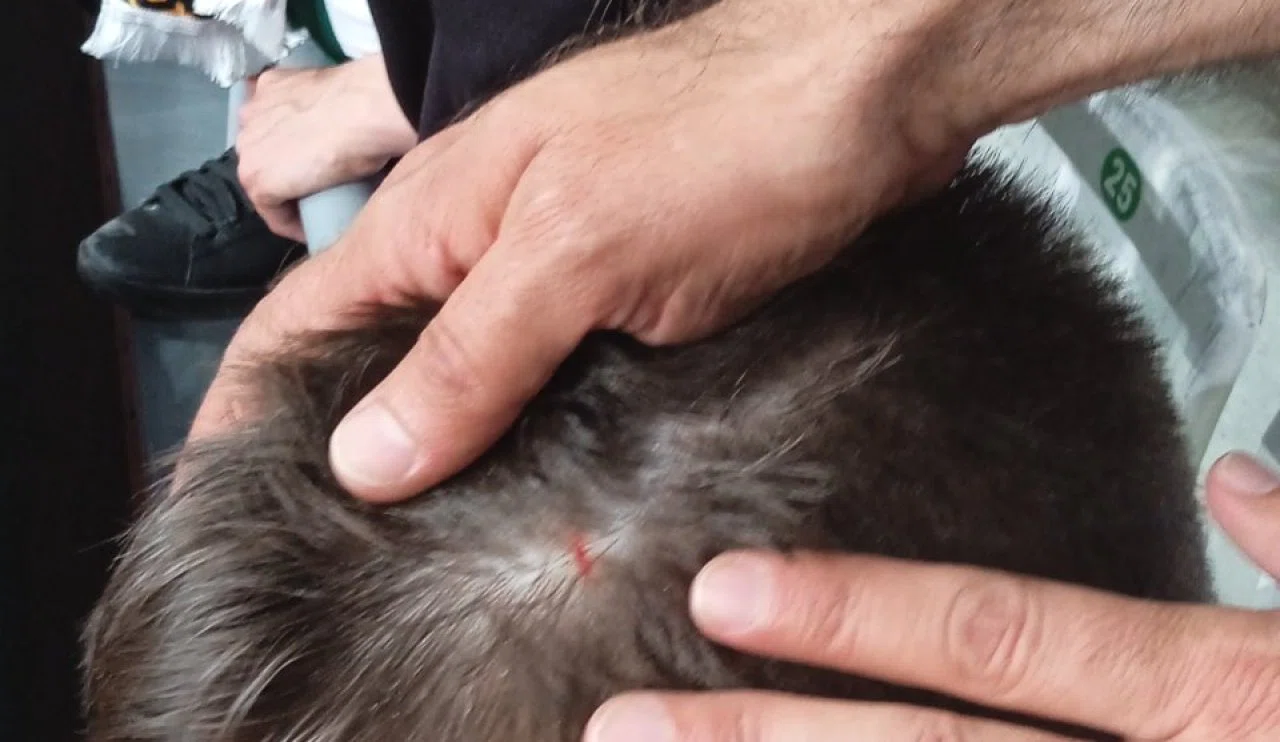 Konyaspor maçında olay! Alanyaspor'un Fransız oyuncusu, minik taraftarı yaraladı!