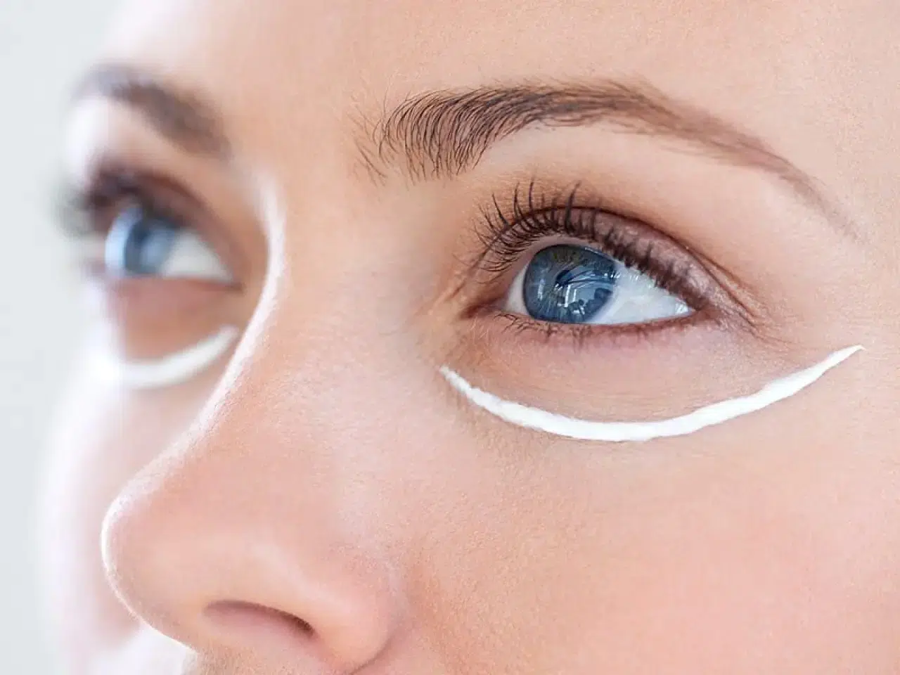 Göz Altı Torbalarının Sebebi Yedikleriniz Olabilir! İşte Şişkinliği Arttıran ve Önleyen Besinler