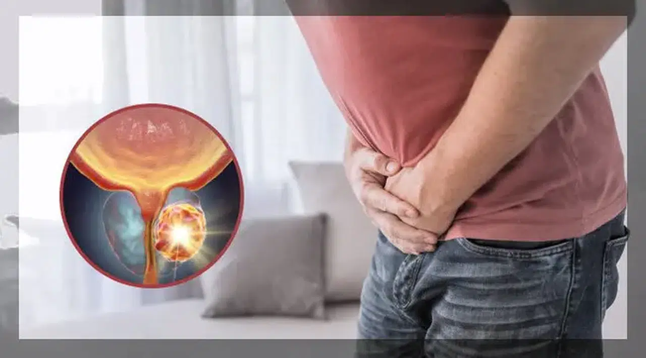 Erkekler için kritik uyarı! Bu kanser belirti vermeden sessiz ilerliyor