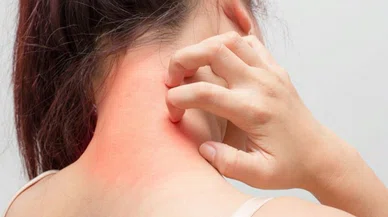 Boyundaki kitlelere dikkat! Uzmanlar uyarıyor...