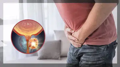 Erkekler için kritik uyarı! Bu kanser belirti vermeden sessiz ilerliyor