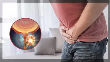 Erkekler için kritik uyarı! Bu kanser belirti vermeden sessiz ilerliyor