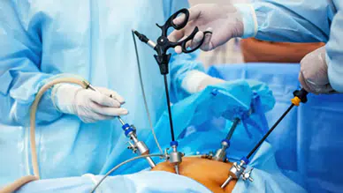 Tüp mide ameliyatı sonrası vücut baştan aşağı değişiyor!