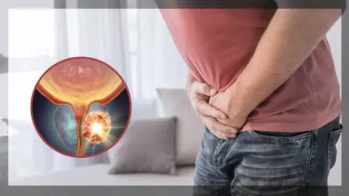 Erkekler için kritik uyarı! Bu kanser belirti vermeden sessiz ilerliyor