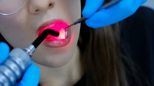 Konya merkezli araştırma ses getirdi: Lazerle hızlı iyileşme mümkün mü?