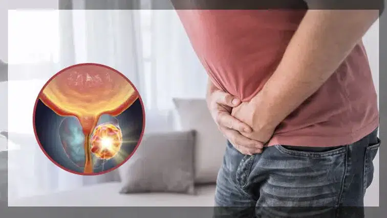 Erkekler için kritik uyarı! Bu kanser belirti vermeden sessiz ilerliyor