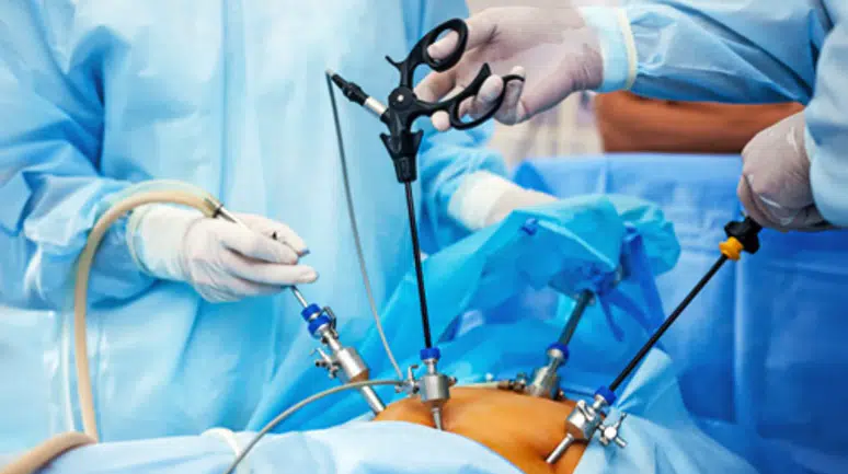 Tüp mide ameliyatı sonrası vücut baştan aşağı değişiyor!