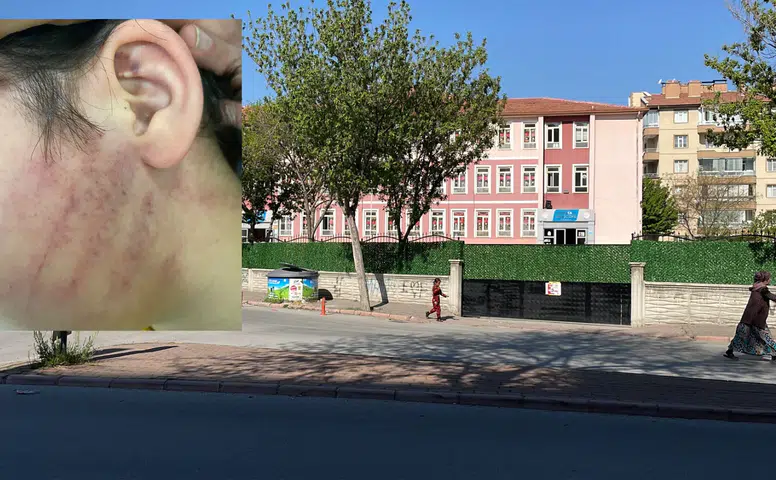 Konya'da veliler 8 yaşındaki çocukları darp etmişti! İstenen ceza belli oldu