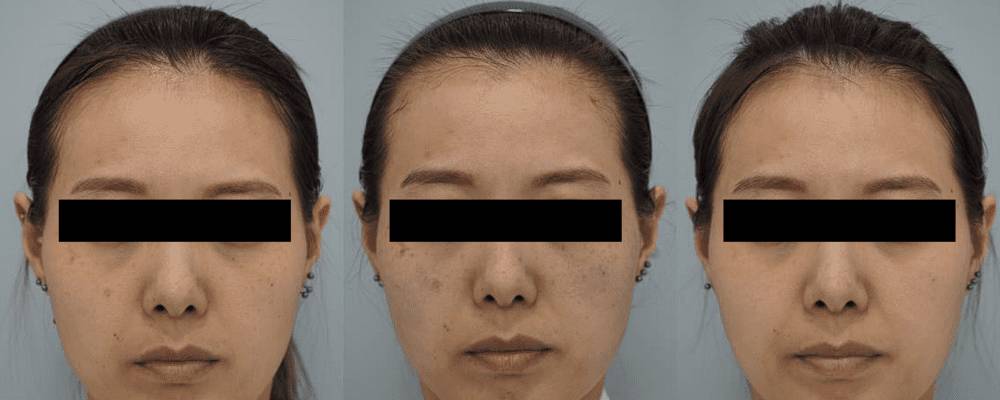 Şekeri tamamen bıraktıktan sonra vücutta meydana gelen inanılmaz 6 değişiklik 3